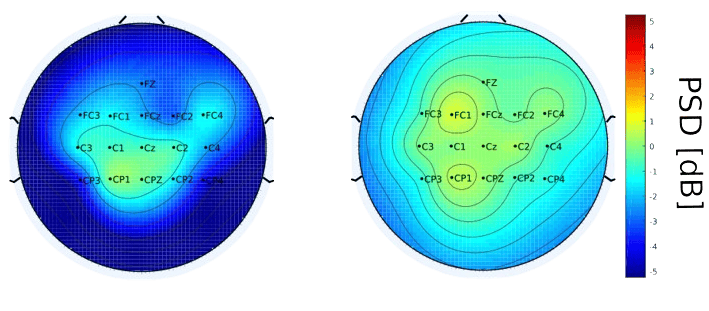 Brain Computer Interface
